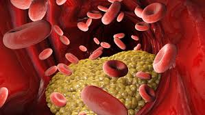 Read more about the article ﮐﻮﻟﯿﺴﭩﺮﻭﻝ ﮐﯿﺎ ﮨﮯ